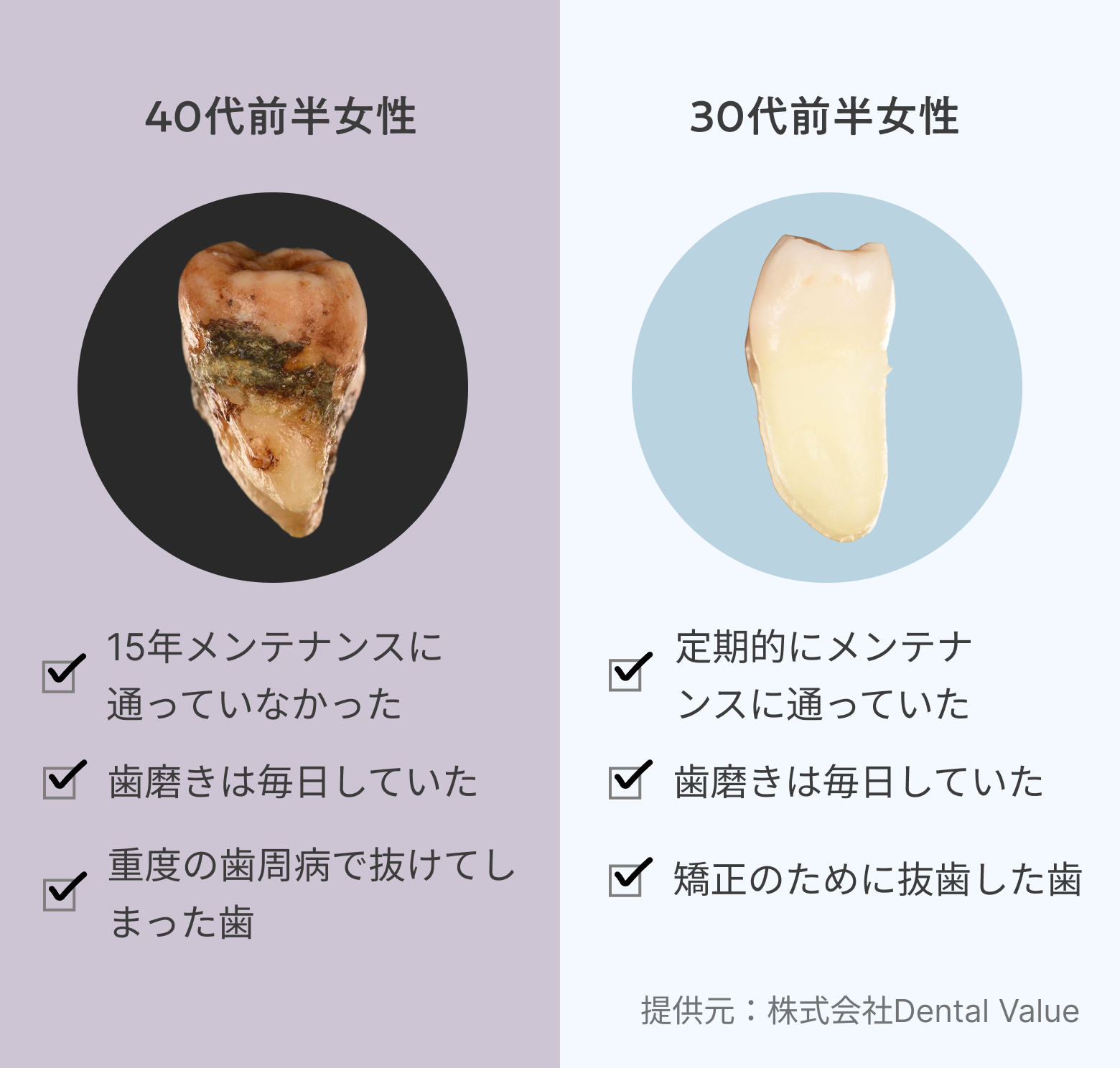 歯の比較図