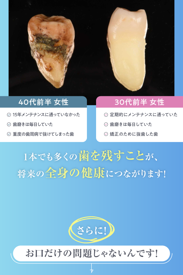 歯を残すことが全身の健康につながる
